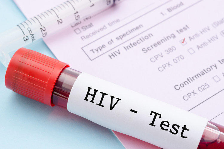СПИД: пути заражения ВИЧ-инфекцией